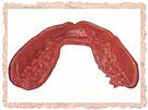 mouthguard1-7